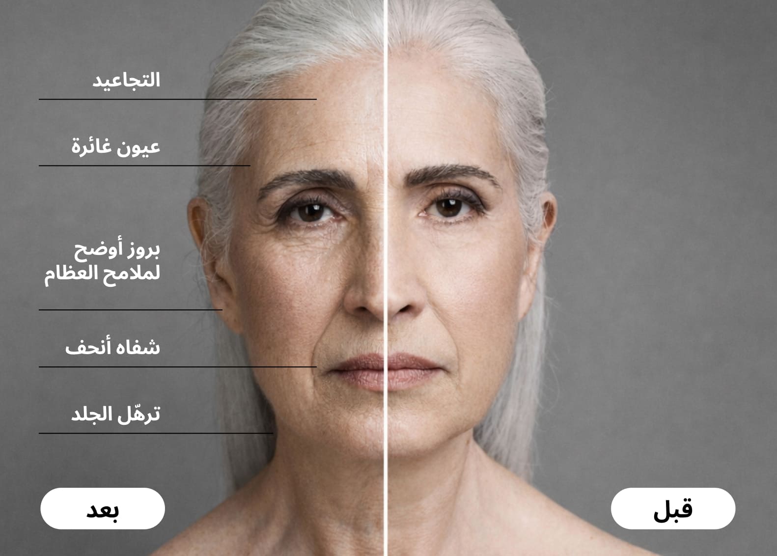 Before and after GLP-1 injection effects on face