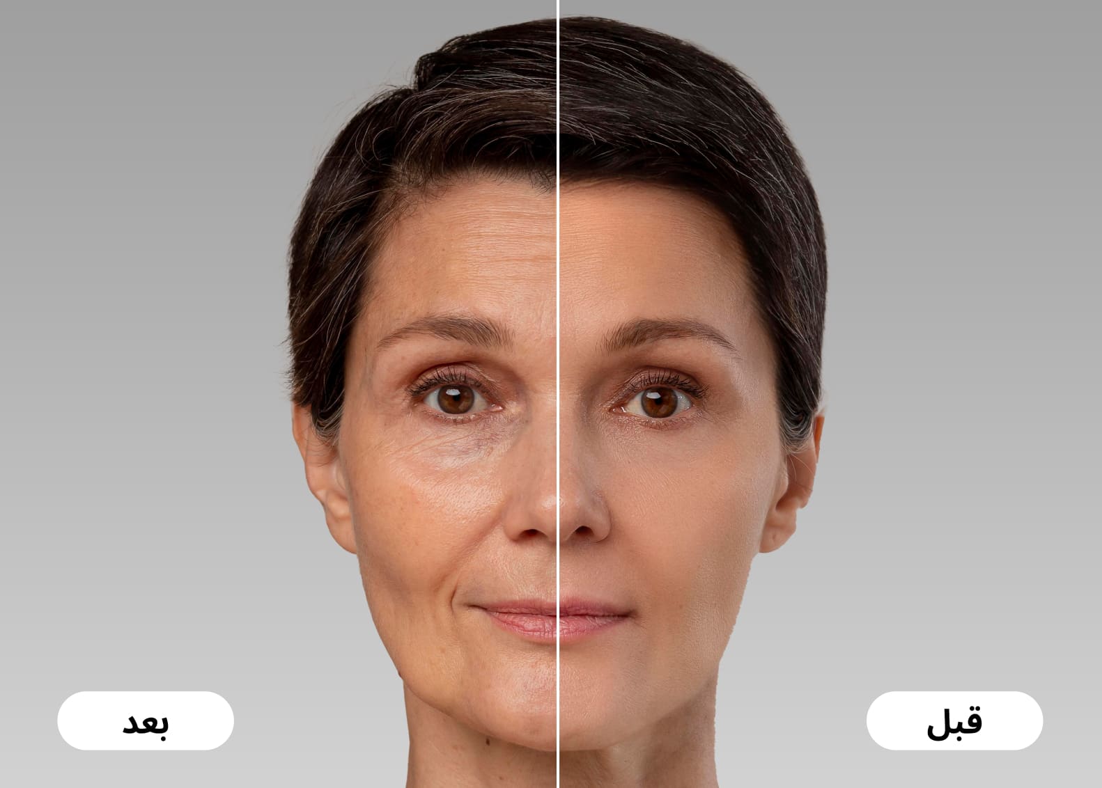 Before and after GLP-1 injection effects