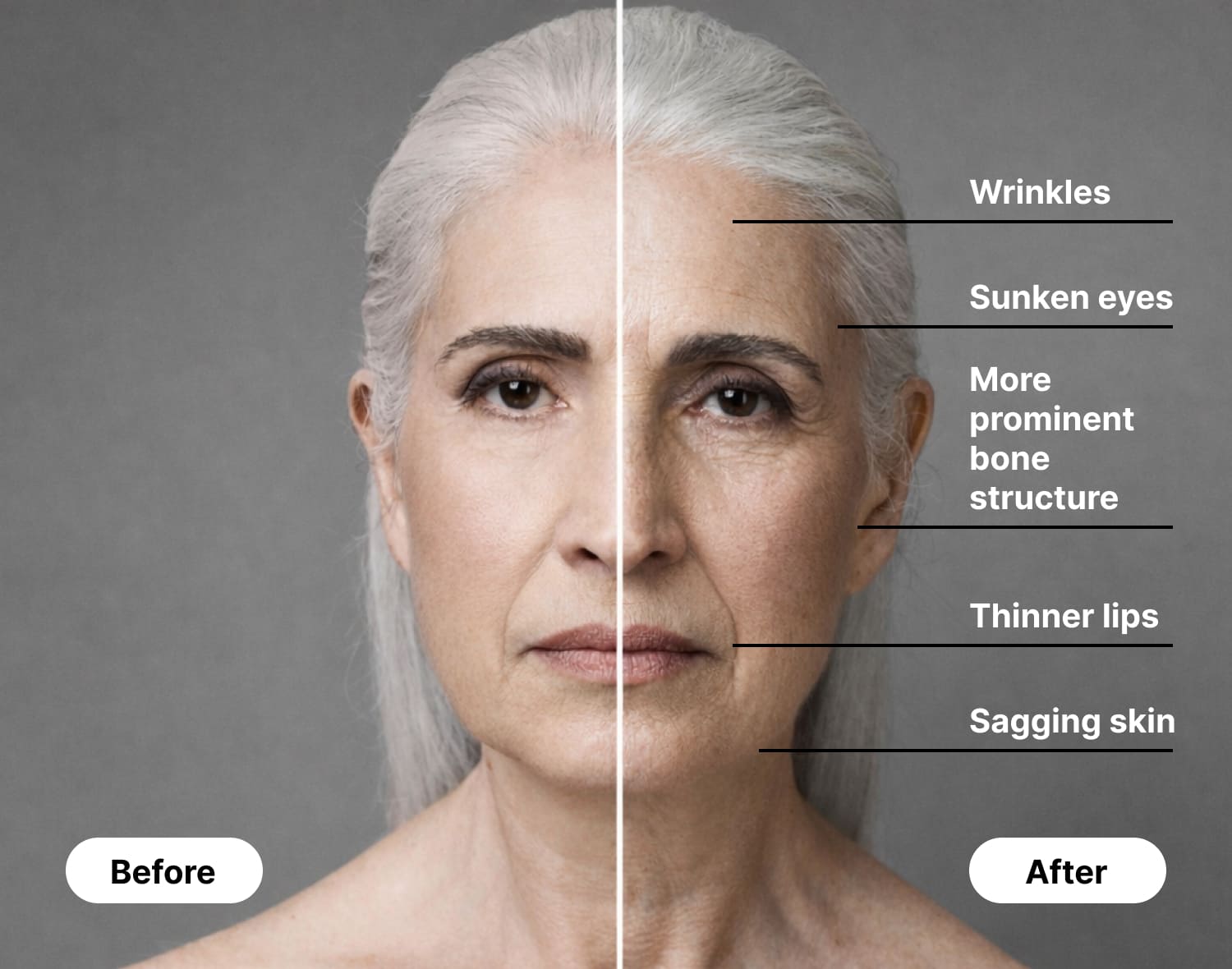 Before and after GLP-1 injection effects on face