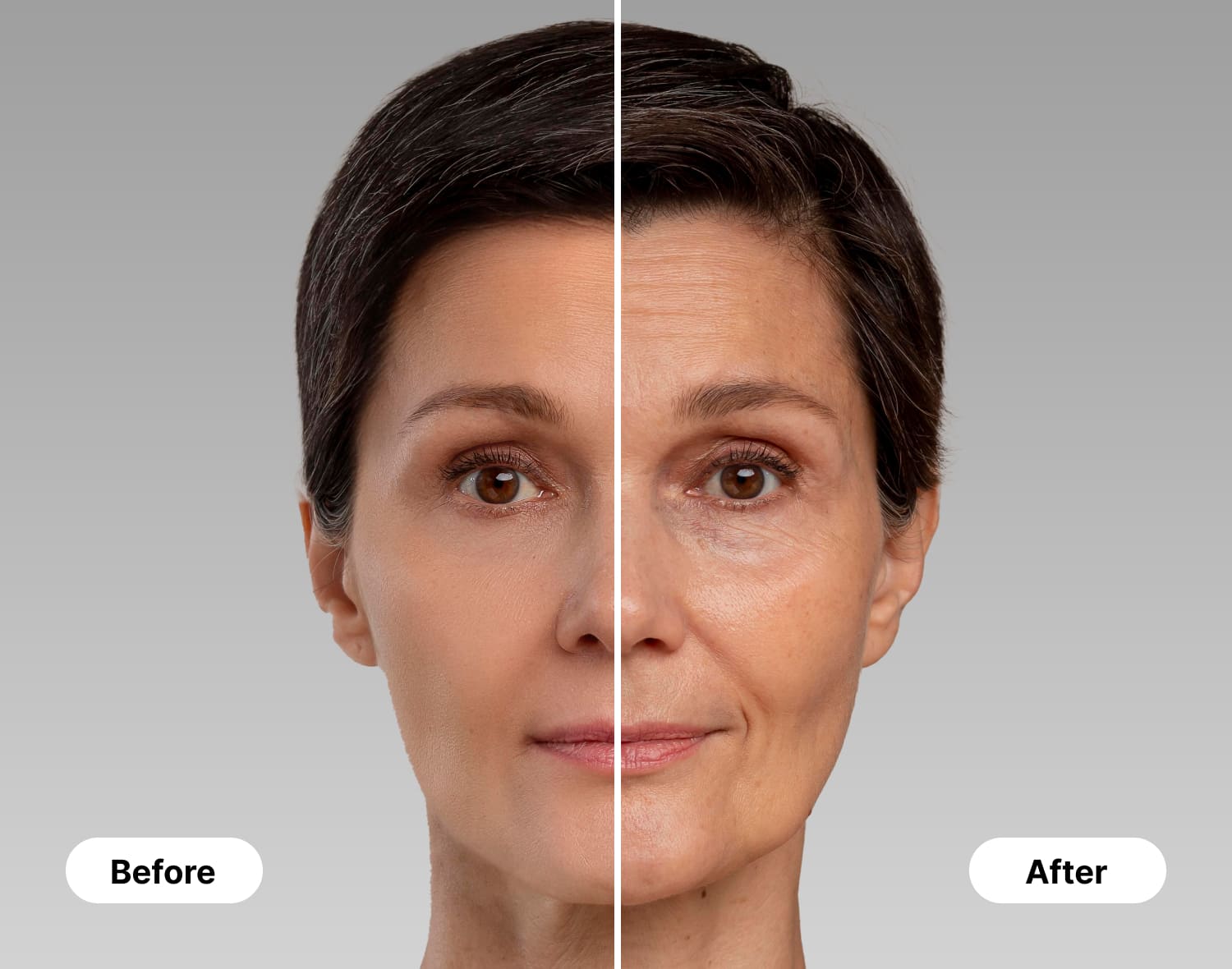 Before and after GLP-1 injection effects