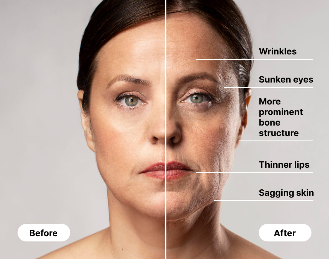 Ozempic face effects